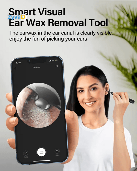 Ear Wax Remover Tool | Smart 1080P HD Visual Stick Otoscope  for Personal Health Care - Zyvlio